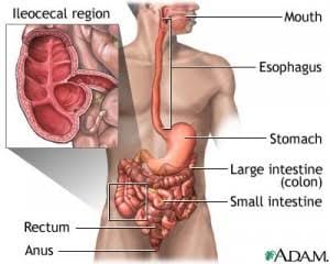 Crohns Disease - Visit Sure Cure